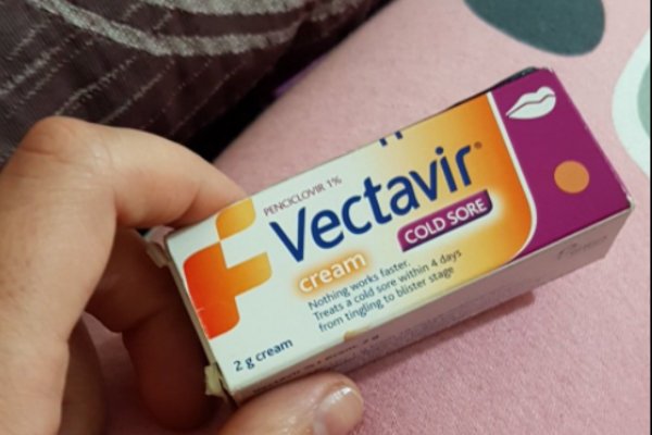 Vectavir krem ne için kullanılır? SGK karşılıyor mu?