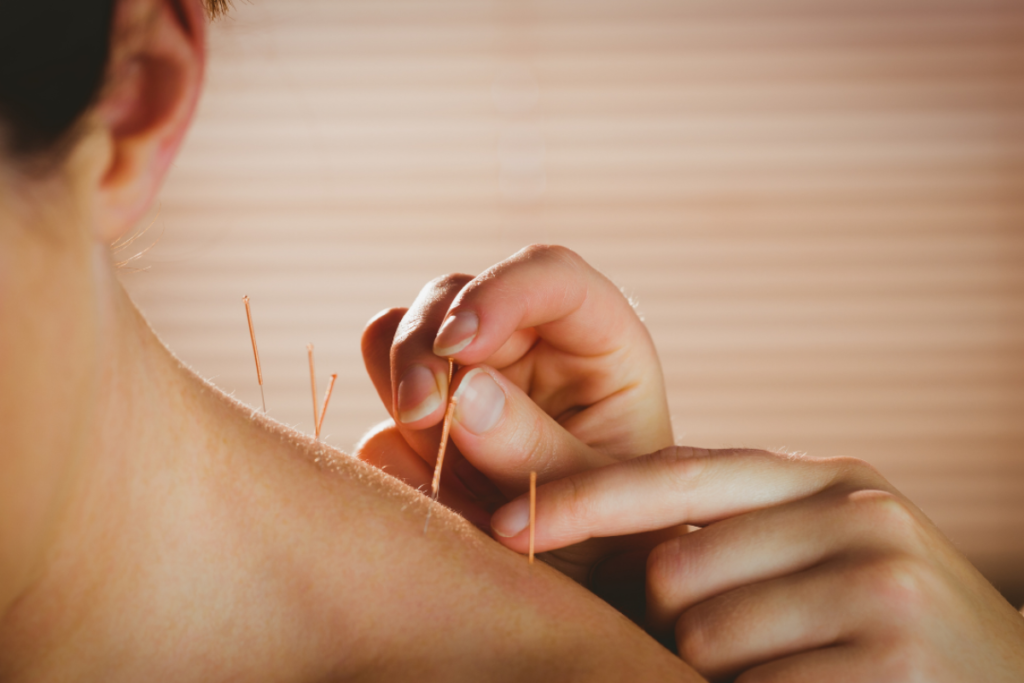 Akupunktur ile alerji tedavisi