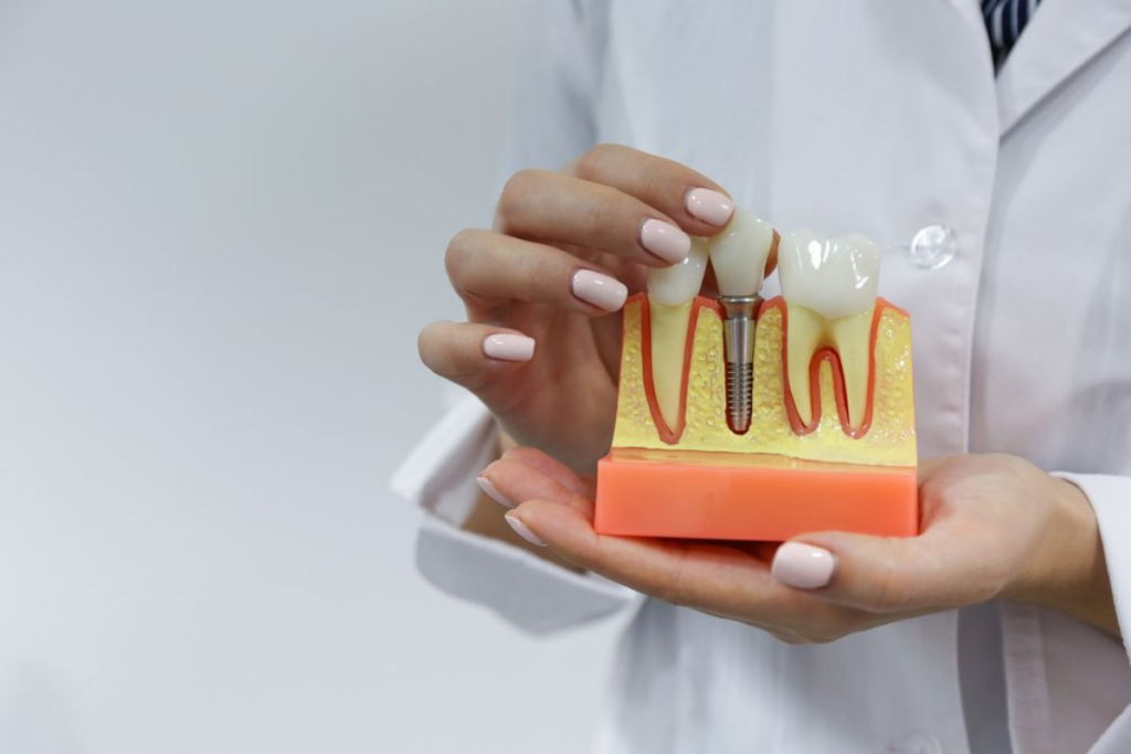 Diş implantı nedir? Nasıl yapılır?