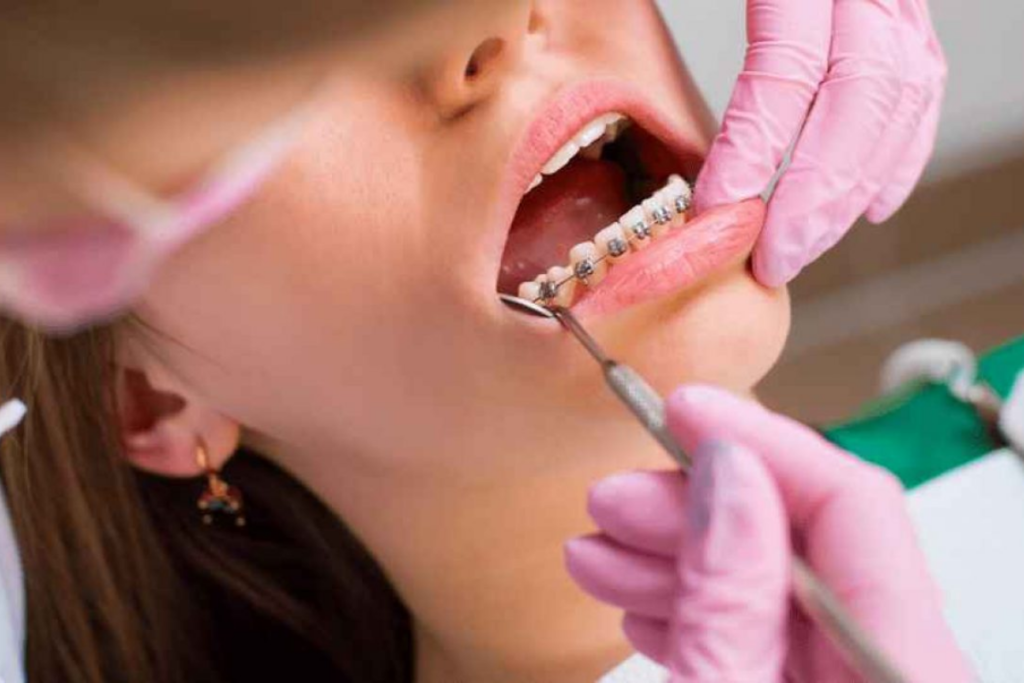 Ortodonti nedir? Neye bakar?