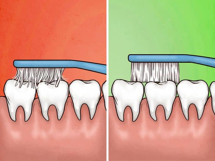 Dişlerinizi Sert Fırçayla Fırçalarsanız 4 Zararlı Etkisi!