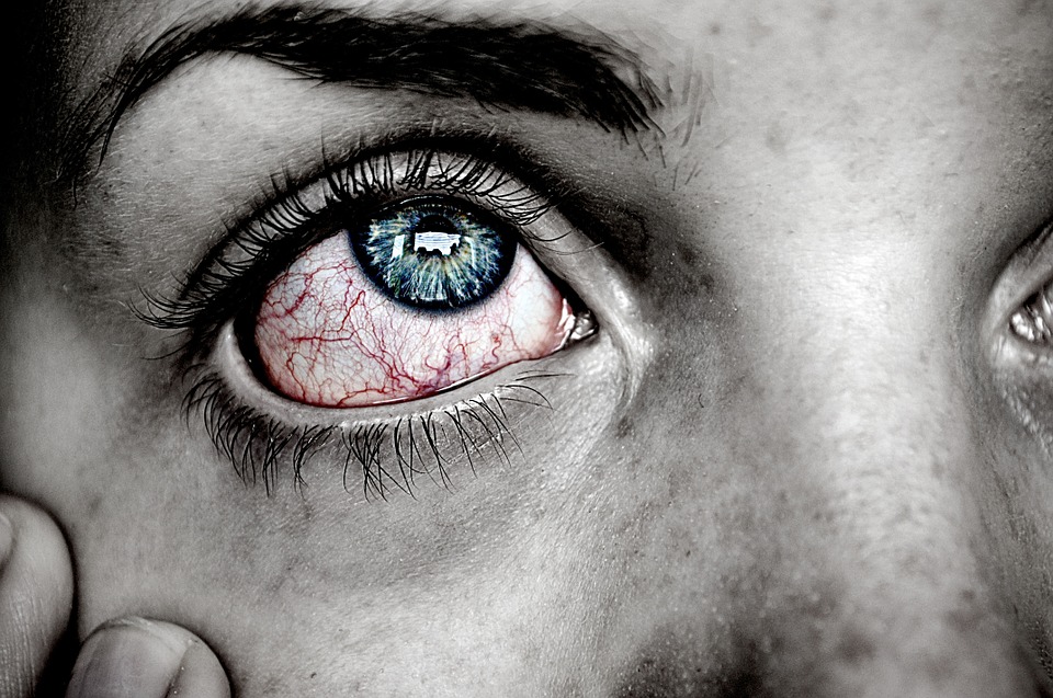 Pembe Göz Hastalığı Nedir?