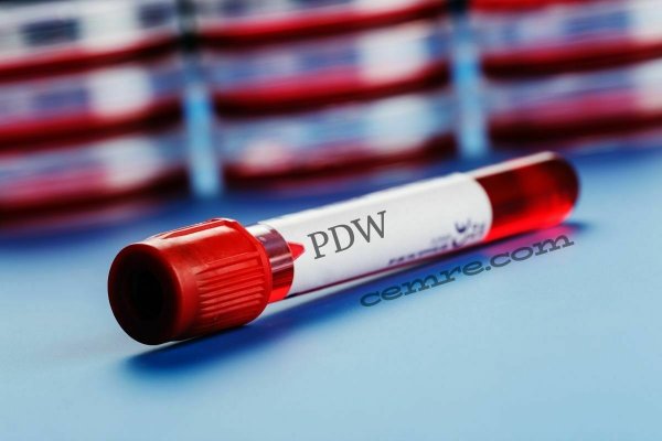 Kan tahlilinde yazan PDW nedir? PDW aralığı kaç olmalı?