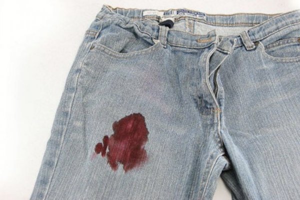 Kot pantolondan kan lekesi nasıl çıkar? Kot pantolon ve kot elbiselerden kan lekesini çıkarmanın pratik yolları nelerdir?