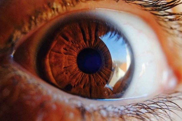 Retina Yırtığı (Dekolmanı) Ameliyatı Sonrası: Görme, İyileşme ve Dikkat Edilmesi Gerekenler