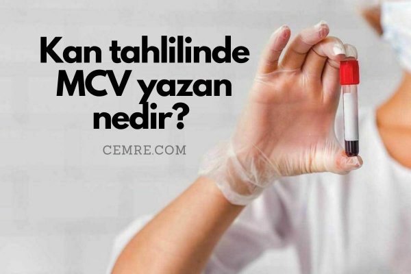 Kan tahlilinde yazan MCV nedir? MCV aralığı kaç olmalı?