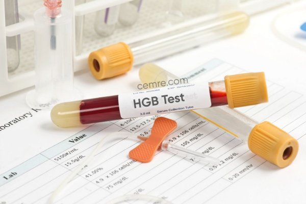 Kan tahlilinde yazan HGB nedir? HGB aralığı kaç olmalı?