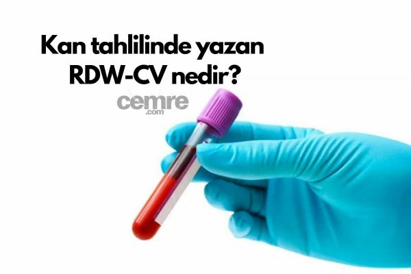 Kan tahlilinde yazan RDW-CV nedir? RDW-CV aralığı kaç olmalı?